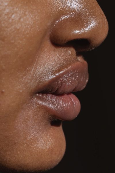 Profil mit Nase, Mund und Kinn von Person mit fettiger Haut